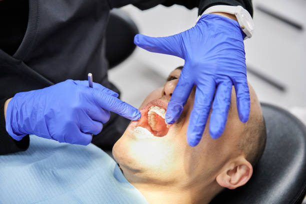 Best Emergency Wisdom Teeth Removal in Bohners Lake, WI